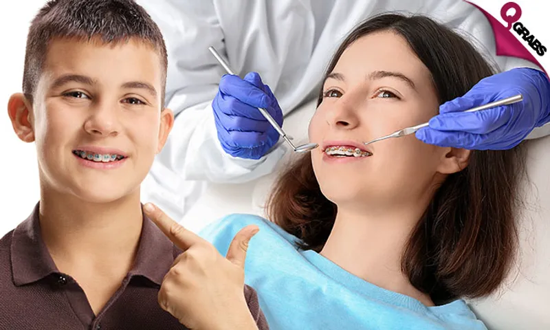 Metal Dental Braces!